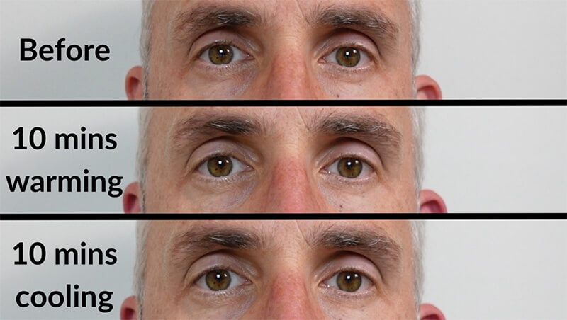 Three photos of the same man's eyes. Before using the Eye Tech mask. After 10 minutes with  the warm mode. After 10 minutes with the cool mode.